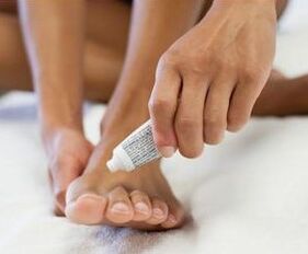 Treatment of fungi