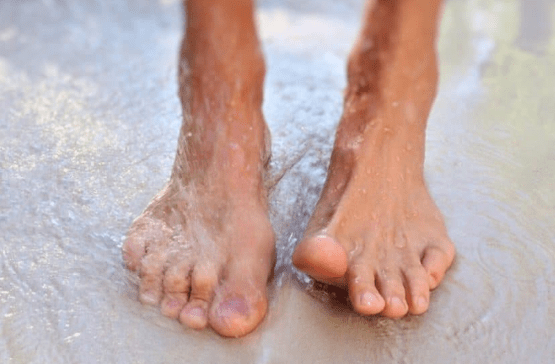 Causes of mycosis development